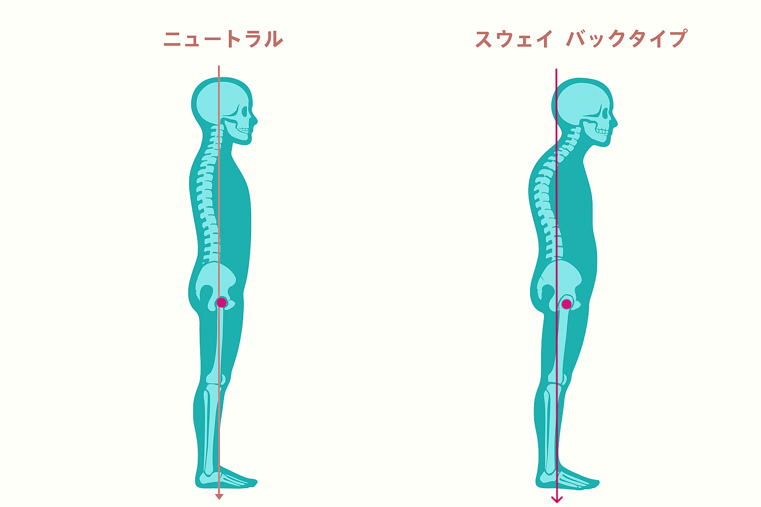 バッティングで下半身が使えない原因となるスウェイバック姿勢と正しい姿勢の比較画像